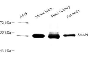 Western blot analysis of SMAD9 (ABIN7075625) at dilution of 1: 1000 (SMAD9 抗体)