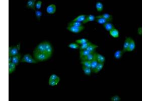 Immunofluorescence staining of PC-3 cells with ABIN7146614 at 1:133, counter-stained with DAPI. (PKIG 抗体  (AA 1-76))