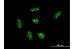 Immunofluorescence of monoclonal antibody to RPL21 on HeLa cell. (RPL21 抗体  (AA 2-85))