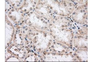 Immunohistochemical staining of paraffin-embedded Human liver tissue using anti-PDE4A mouse monoclonal antibody. (PDE4A 抗体)