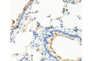 Immunohistochemistry of paraffin-embedded Rat lung using RGS5 Polyclonal Antibody at dilution of 1:100 (40x lens). (RGS5 抗体)