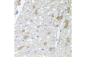 Immunohistochemistry of paraffin-embedded rat brain using RAPSN antibody (ABIN6132583, ABIN6146690, ABIN6146691 and ABIN6222434) at dilution of 1:100 (40x lens). (RAPSN 抗体  (AA 1-353))