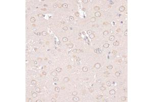 Immunohistochemistry of paraffin-embedded mouse brain using ABCF2 antibody (ABIN6291735) at dilution of 1:100 (40x lens). (ABCF2 抗体)