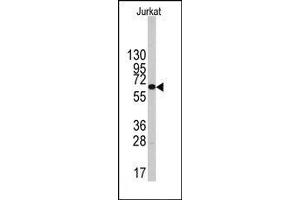 Image no. 1 for anti-6-phosphofructo-2-Kinase/fructose-2,6-Biphosphatase 1 (PFKFB1) (Middle Region) antibody (ABIN360657) (PFKFB1 抗体  (Middle Region))