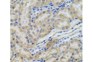 Immunohistochemistry of paraffin-embedded Rat kidney using PCSK9 Polyclonal Antibody at dilution of 1:100 (40x lens).