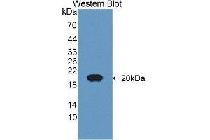 Detection of Recombinant MHCDG, Human using Polyclonal Antibody to Cluster Of Differentiation 74 (CD74) (CD74 抗体  (AA 78-222))