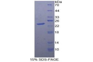 SDS-PAGE analysis of Human PTPRN Protein. (PTPRN 蛋白)