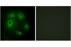 Immunofluorescence (IF) image for anti-Deleted in Lung and Esophageal Cancer 1 (DLEC1) (AA 1-50) antibody (ABIN2889814) (DLEC1 抗体  (AA 1-50))