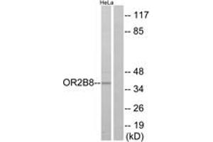 Western blot analysis of extracts from HeLa cells, using OR2B8 Antibody. (OR2B8P 抗体  (AA 61-110))