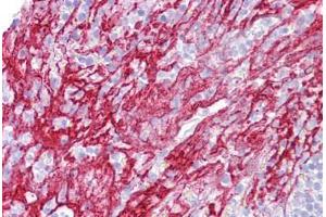 Anti-APOH / Apolipoprotein H antibody IHC staining of human tonsil. (APOH 抗体  (AA 143-192))