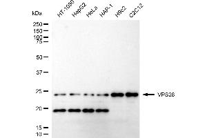 Western blotting analysis using VPS28 antibody (ABIN7800926). (Recombinant VPS28 抗体)