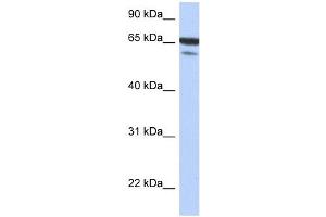 MAP3K7IP1 antibody used at 1 ug/ml to detect target protein. (TAB1 抗体  (N-Term))