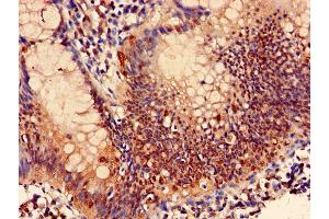 Immunohistochemistry (IHC) image for anti-Proteasome (Prosome, Macropain) Subunit, beta Type, 7 (PSMB7) (AA 44-275) antibody (ABIN7164986)