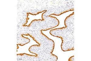 Immunohistochemistry analysis of paraffin embedded rat bladder using TGDS (ABIN7075850) at dilution of 1: 1500 (TGDS 抗体)