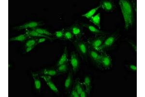 Immunofluorescence staining of Hela cells with ABIN7161386 at 1:133, counter-stained with DAPI. (NPAS2 抗体  (AA 644-763))