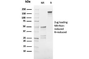 SDS-PAGE Analysis Purified hCG beta Mouse Monoclonal Antibody (HCGb/54). (CGB 抗体)