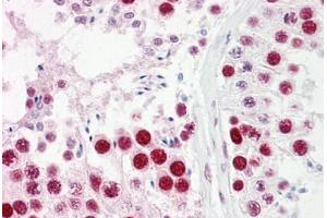 Anti-UBA2 antibody IHC staining of human testis. (UBA2 抗体  (AA 591-640))