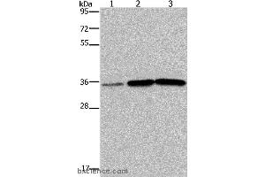 Western blot analysis of Human testis tissue, A549 and PC3 cell, using MAGEA3 Polyclonal Antibody at dilution of 1:400 (MAGEA3 抗体)