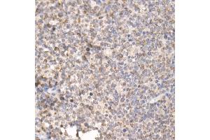 Immunohistochemistry of paraffin-embedded human tonsil using PG Rabbit pAb (ABIN7269317) at dilution of 1:25 (40x lens). (PGAM5 抗体  (AA 30-225))