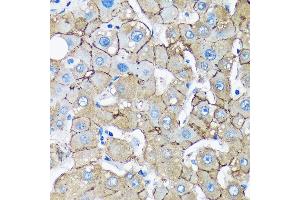 Immunohistochemistry of paraffin-embedded Human liver using UNC13B Rabbit pAb (ABIN7271215) at dilution of 1:100 (40x lens). (UNC13B 抗体  (AA 1-350))