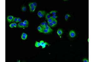 Immunofluorescent analysis of MCF-7 cells using ABIN7172953 at dilution of 1:100 and Alexa Fluor 488-congugated AffiniPure Goat Anti-Rabbit IgG(H+L) (TMCC1 抗体  (AA 51-300))
