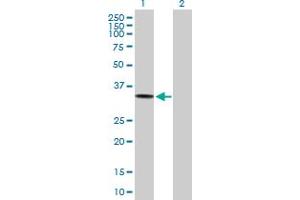 Western Blot analysis of ACP5 expression in transfected 293T cell line by ACP5 MaxPab polyclonal antibody. (ACP5 抗体  (AA 1-325))