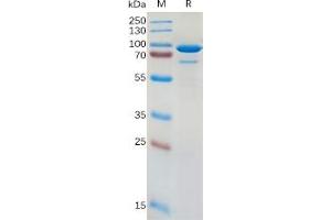 Human CD73 Protein, hFc Tag on SDS-PAGE under reducing condition. (CD73 Protein (Fc Tag))