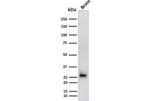 Western Blot Analysis of human Brain tissue lysate using Calretinin Mouse Monoclonal Antibody (CALB2/2602). (Calretinin 抗体  (AA 23-242))