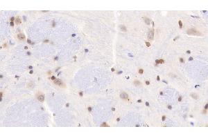 Immunohistochemistry (IHC) image for anti-ADAM Metallopeptidase with Thrombospondin Type 1 Motif, 7 (ADAMTS7) (AA 444-575) antibody (ABIN7434446)