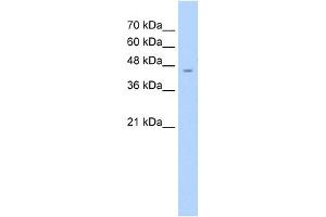 WB Suggested Anti-ASS Antibody Titration:  2. (ASS1 抗体  (C-Term))