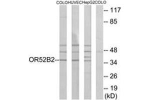 Western blot analysis of extracts from COLO/HuvEc/HepG2 cells, using OR52B2 Antibody. (OR52B2 抗体  (AA 201-250))