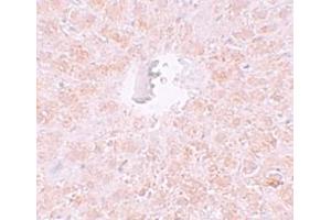 Immunohistochemistry (IHC) image for anti-Piwi-Like 1 (PIWIL1) (N-Term) antibody (ABIN1031515) (PIWIL1 抗体  (N-Term))