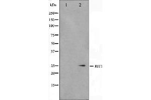 Western blot analysis on Jurkat cell lysate using RIT1 Antibody,The lane on the left is treated with the antigen-specific peptide. (RIT1 抗体  (C-Term))