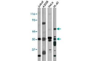 The CHEK1 (phospho S317) polyclonal antibody  is used in Western blot for detection in, from left to right, Jurkat, A-2058, Hela, and HL-60 cell lysates.