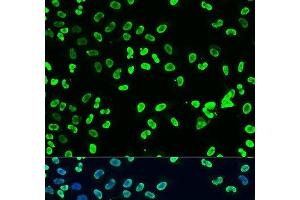 Immunofluorescence analysis of U2OS cells using DiMethyl-DNMT3A-K44 Polyclonal Antibody at dilution of 1:100. (DNMT3A 抗体  (2meLys44))
