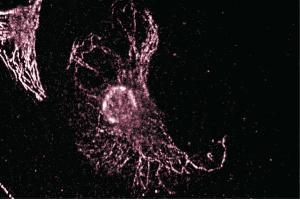 Immunofluorescent staining of NRK cells. (TRIP10 抗体  (AA 411-501))
