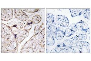 Immunohistochemistry analysis of paraffin-embedded human placenta tissue using PHCA antibody. (ACER3 抗体  (Internal Region))