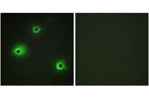 Immunofluorescence analysis of A549 cells, using GRAH Antibody. (GZMH 抗体  (AA 51-100))