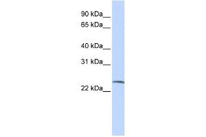 WB Suggested Anti-SSX6 Antibody Titration:  0. (SSX6 抗体  (Middle Region))