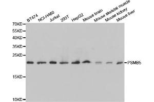 Western blot analysis of extracts of various cell lines, using PSMB5 antibody (ABIN5971025) at 1/1000 dilution. (PSMB5 抗体)