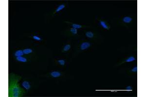 Immunofluorescence of purified MaxPab antibody to IFIT2 on HeLa cell. (IFIT2 抗体  (AA 1-484))