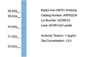WB Suggested Anti-CNTD1  Antibody Titration: 0. (CNTD1 抗体  (N-Term))