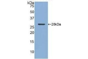 Detection of Recombinant CLU, Human using Polyclonal Antibody to Clusterin (CLU) (Clusterin 抗体  (AA 228-449))