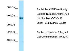 Western Blotting (WB) image for anti-Atrial Natriuretic Peptide Receptor 3 (NPR3) (C-Term) antibody (ABIN2789944) (NPR3 抗体  (C-Term))