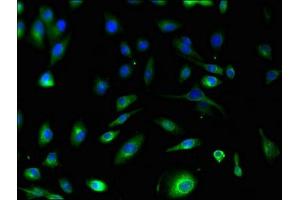 Immunofluorescent analysis of U251 cells using ABIN7166034 at dilution of 1:100 and Alexa Fluor 488-congugated AffiniPure Goat Anti-Rabbit IgG(H+L) (S1A1 (AA 2-97) 抗体)