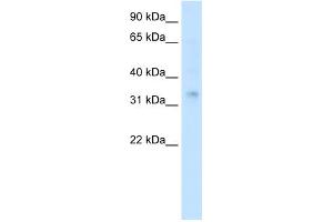 WB Suggested Anti-HOXA2 Antibody Titration:  0. (HOXA2 抗体  (Middle Region))