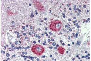 Human Brain, cerebellum: Formalin-Fixed, Paraffin-Embedded (FFPE) (GRHL2 抗体  (C-Term))