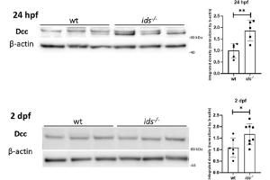 Representative western blot for Dcc at 24 hpf (left) and 2 dpf (right). (DCC 抗体  (Middle Region))