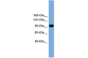 WB Suggested Anti-Parp8 Antibody Titration: 0. (PARP8 抗体  (N-Term))