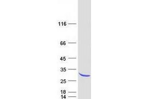 Validation with Western Blot